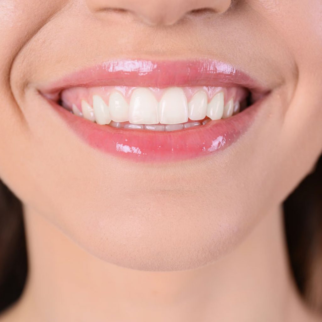 Tratamiento de estética dental — sonrisa restaurada con criterio clínico en BGA Palermo