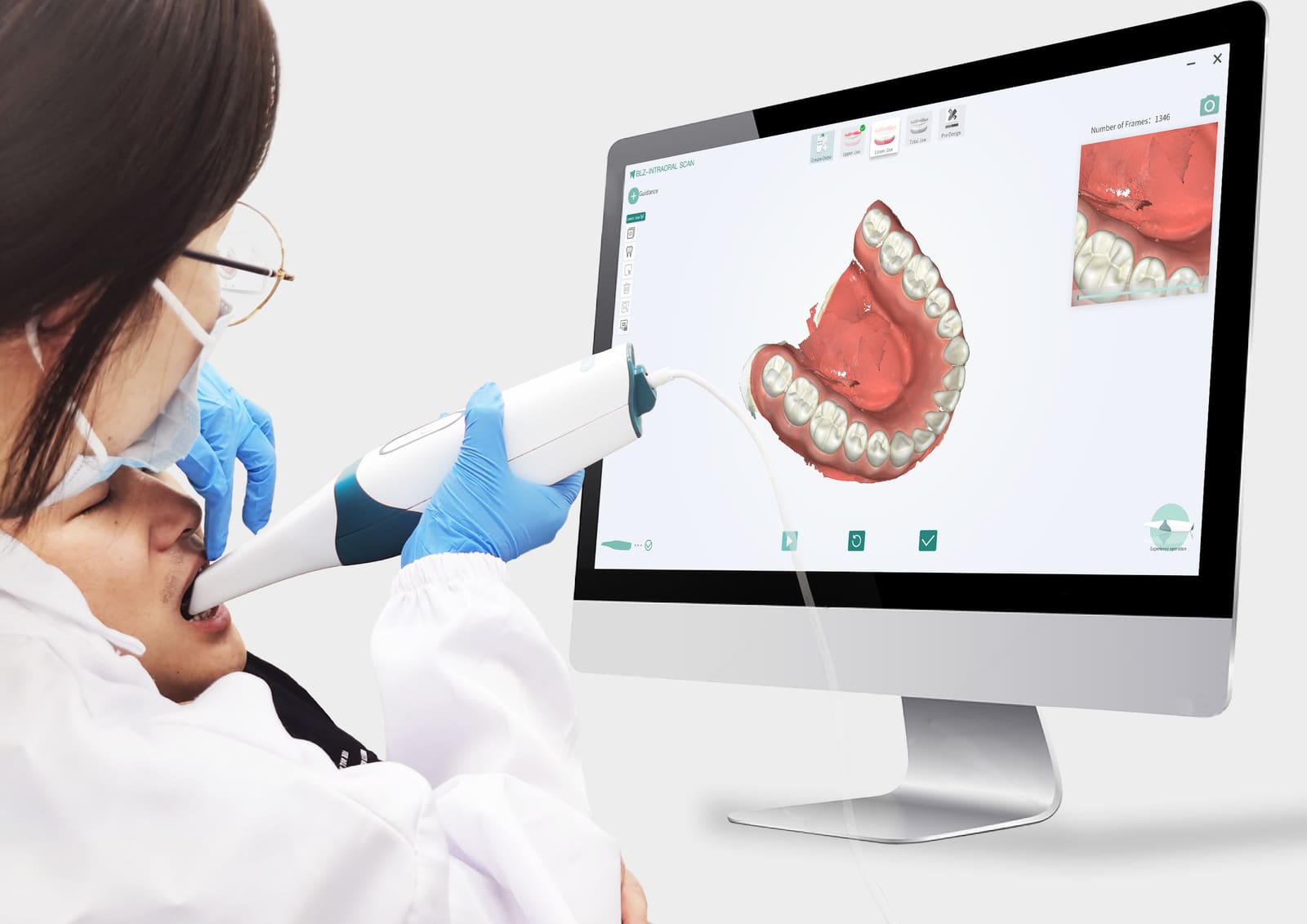 Scanner intraoral de alta precisión para diseño de sonrisa en BGA Palermo — pantalla con modelo 3D dental